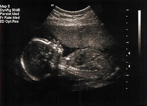 18 WEEKS PREGNANT AND BABY DEVELOPMENT