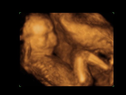 19 WEEKS PREGNANT AND BABY DEVELOPMENT