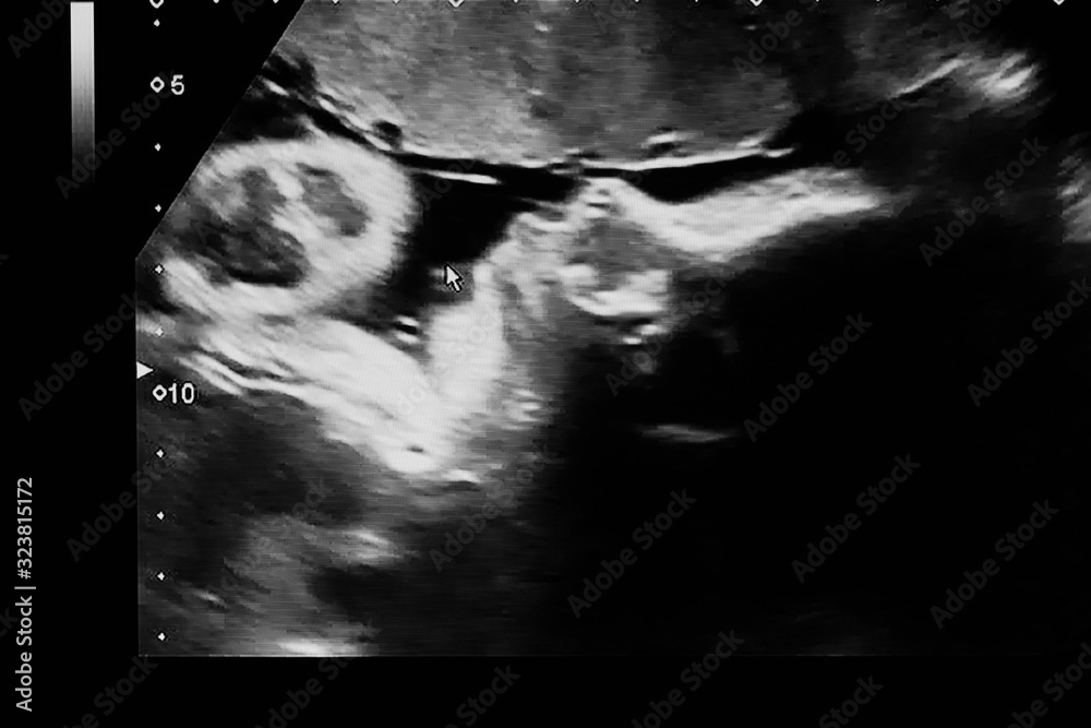 35 weeks pregnant ultrasound