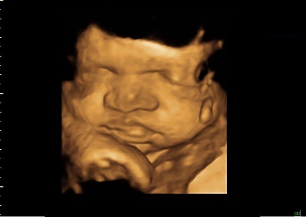 38 weeks ultrasound