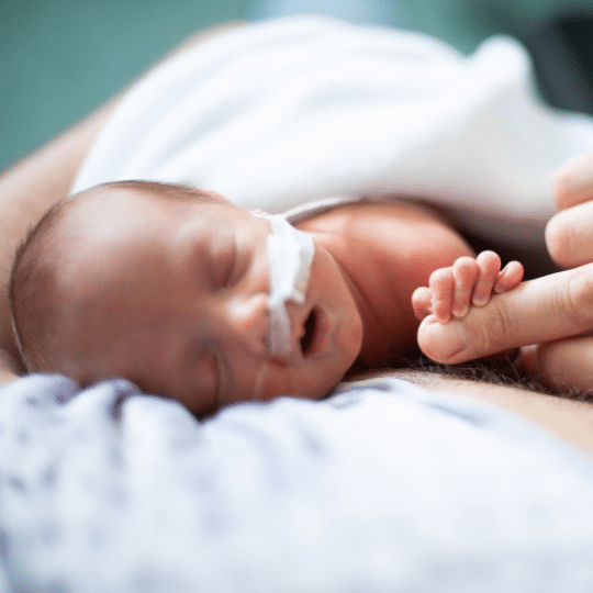 Apnoea in Premature Babies