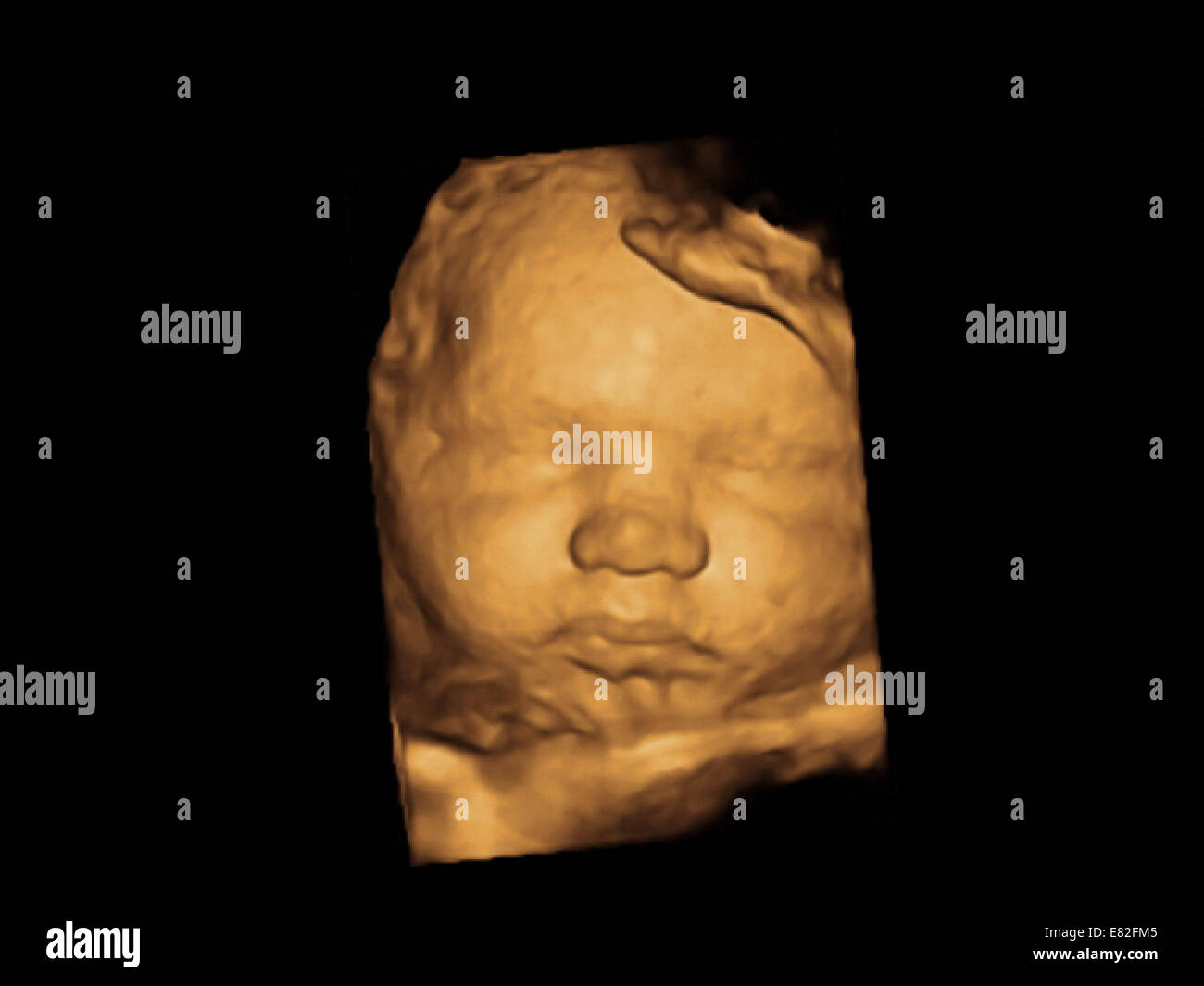 36 WEEKS PREGNANT ULTRASOUND