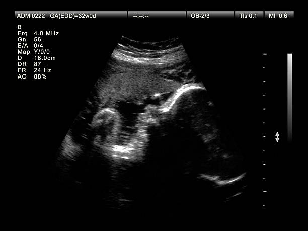 32 weeks pregnant ultrasound
