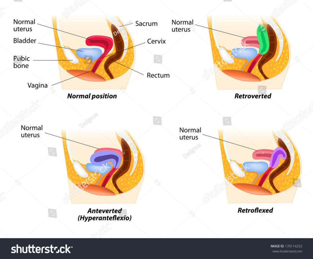 Bu görsel boş bir alt niteliğe sahip; dosya adı stock-photo-uterine-position-normal-uterus-rests-on-the-superior-surface-of-the-empty-bladder-normal-uterus-170114252-1024x849.jpg